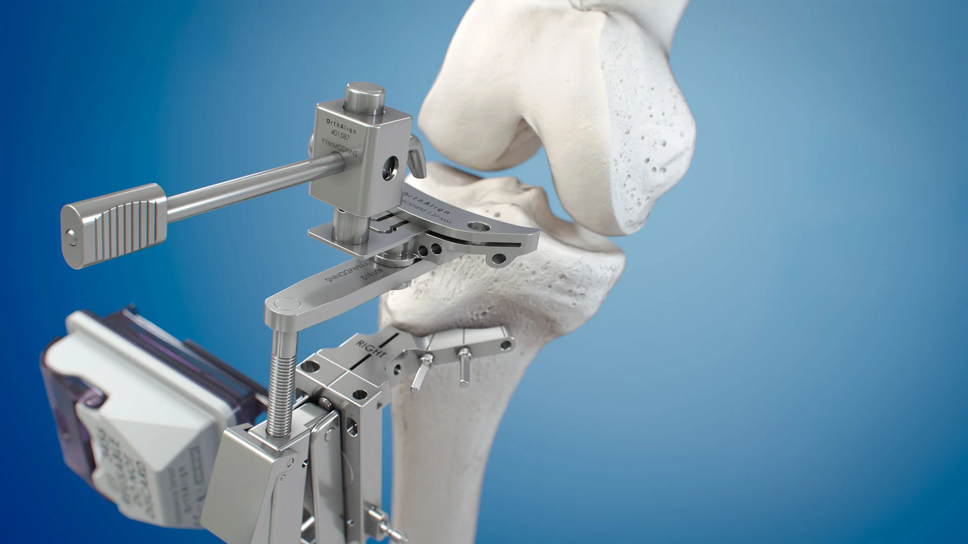 Surgical Procedure Visualization