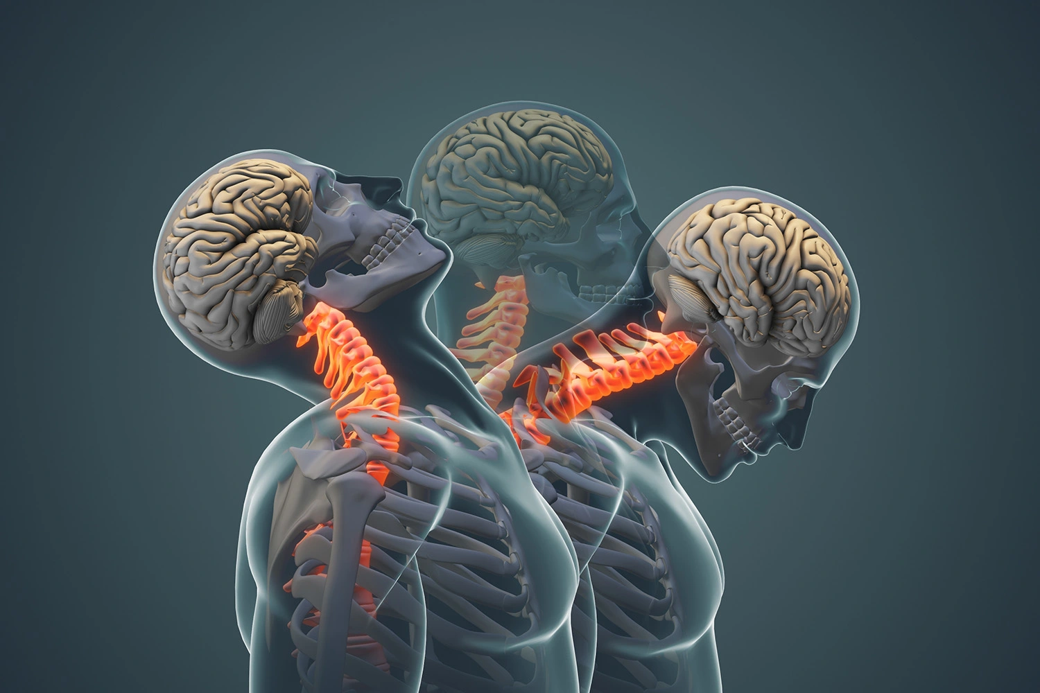Medical Animation
